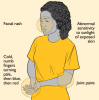files_articles_joints_pain[1970eaff7cee3782d8a6f6efdf17c166].png